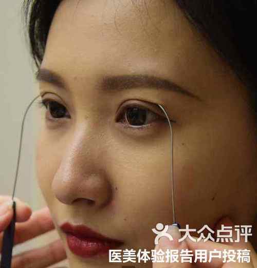 双眼皮效果模拟app游戏截图