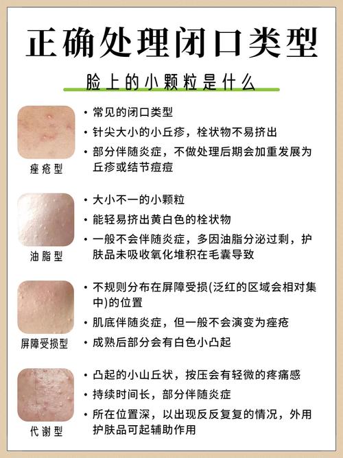 皮脂腺增生的原因