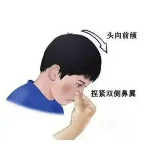 流鼻血长什么样图标
