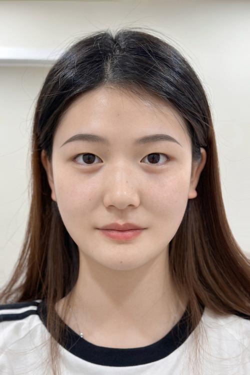 眼睛单眼皮变成内双了图标