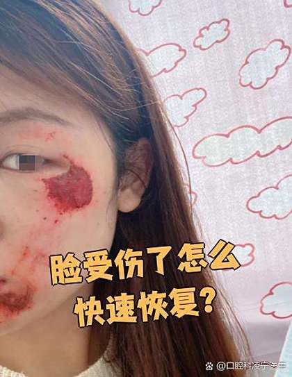 脸部受伤特效软件缩略图