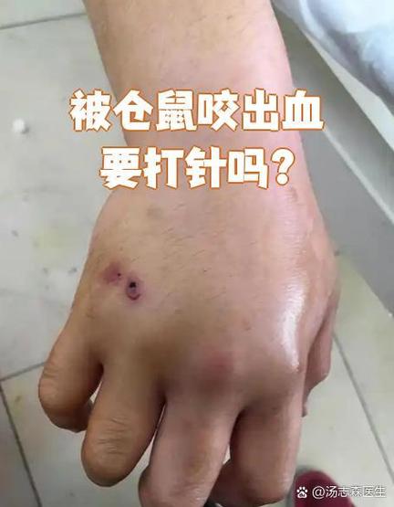 被仓鼠咬了一天后还是疼图标