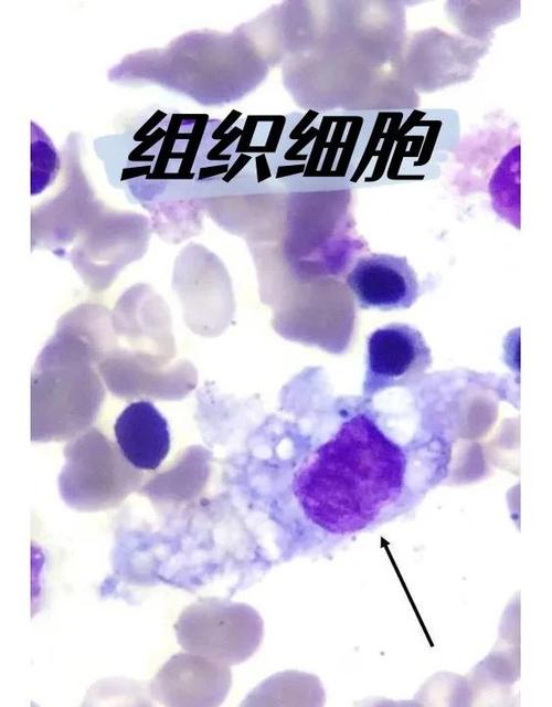 造胞细胞缩略图