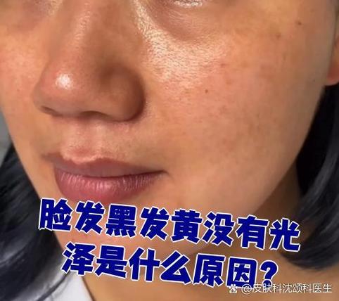 脸黑无光泽是什么原因缩略图