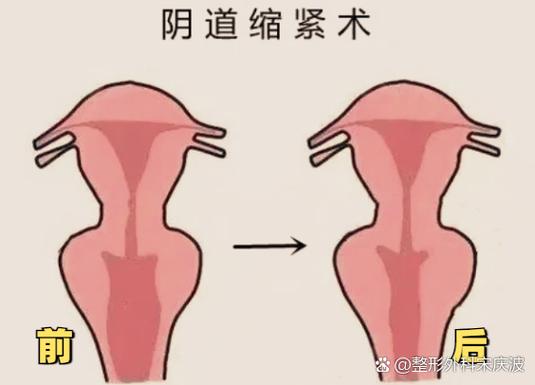 下面变紧致的方法图标