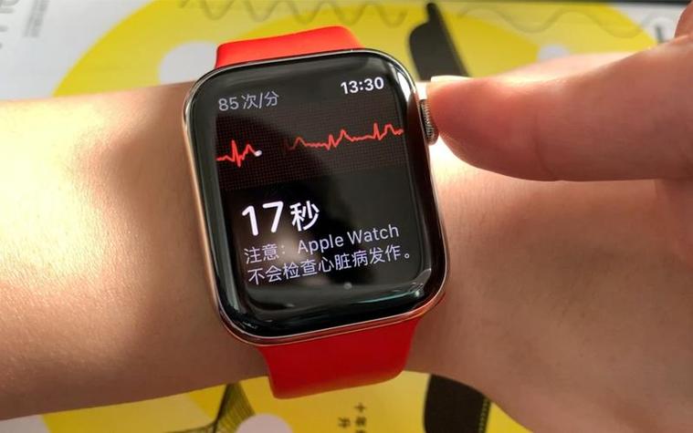 苹果手表app无法安装缩略图