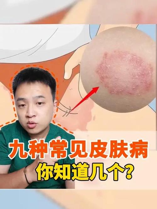 皮肤病的种类游戏截图