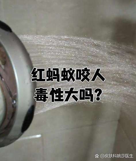 红蚂蚁咬人毒性大吗
