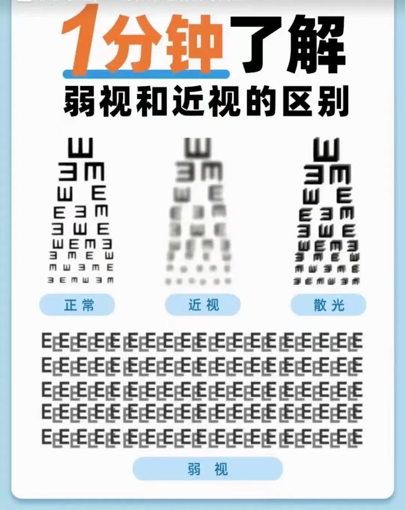 免费弱视训练500种