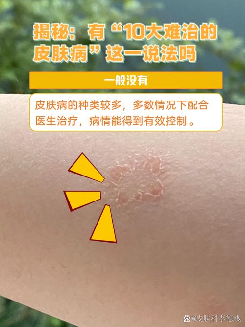 百度扫一扫识别皮肤病最新tv版游戏截图
