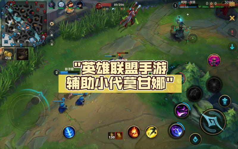 英雄联盟手游辅助