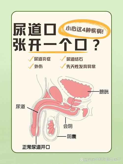 100款禁用黄免费a尿道口