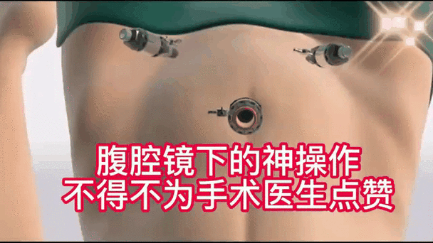 阑尾炎手术3d演示游戏截图