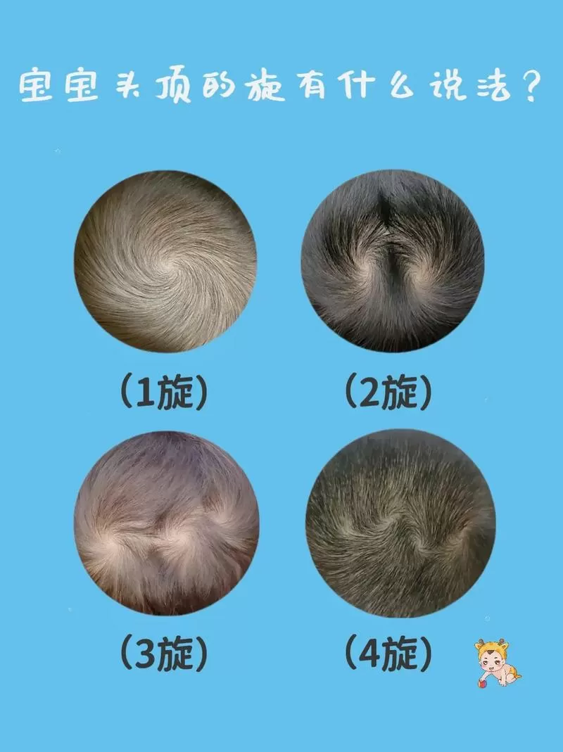 正常的头顶头旋照片图标