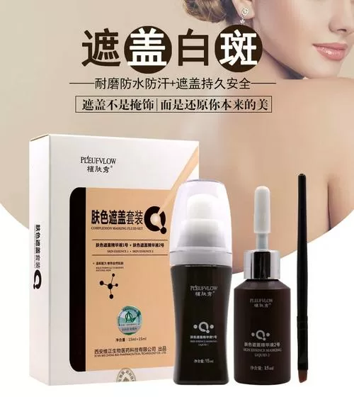 遮盖白斑小妙招缩略图
